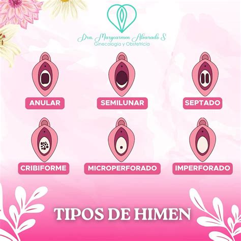 tipuri de himen|himen